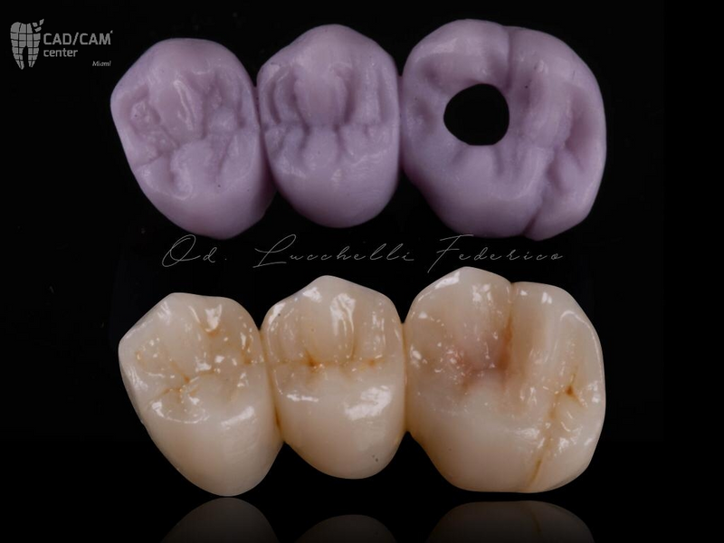 CEREC Stain & Glaze Kit