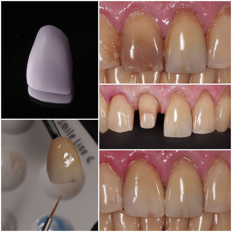 CEREC Stain & Glaze Kit