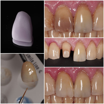 CEREC Stain & Glaze Kit