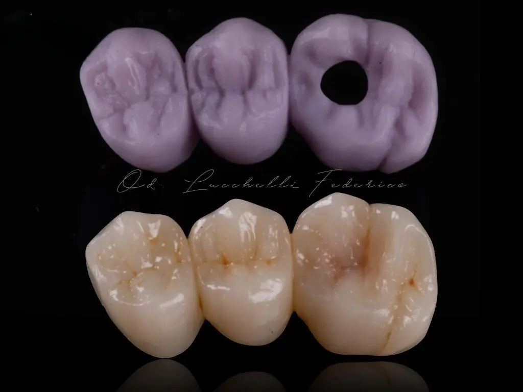 CEREC® Blue Blocks Lithium Disilicate x5