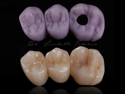 CEREC® Bridge Blocks Lithium Disilicate (e.max) B40